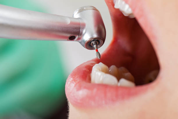 Best Emergency Tooth Extraction in Cohoe, AK